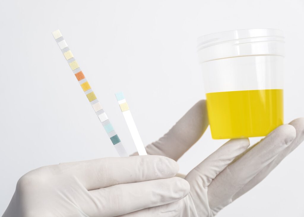 el cbd da positivo en test de orina